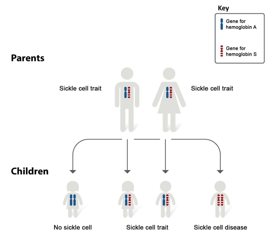 Educational diagram showing inheritance patterns of sickle cell disease using a genetic chart