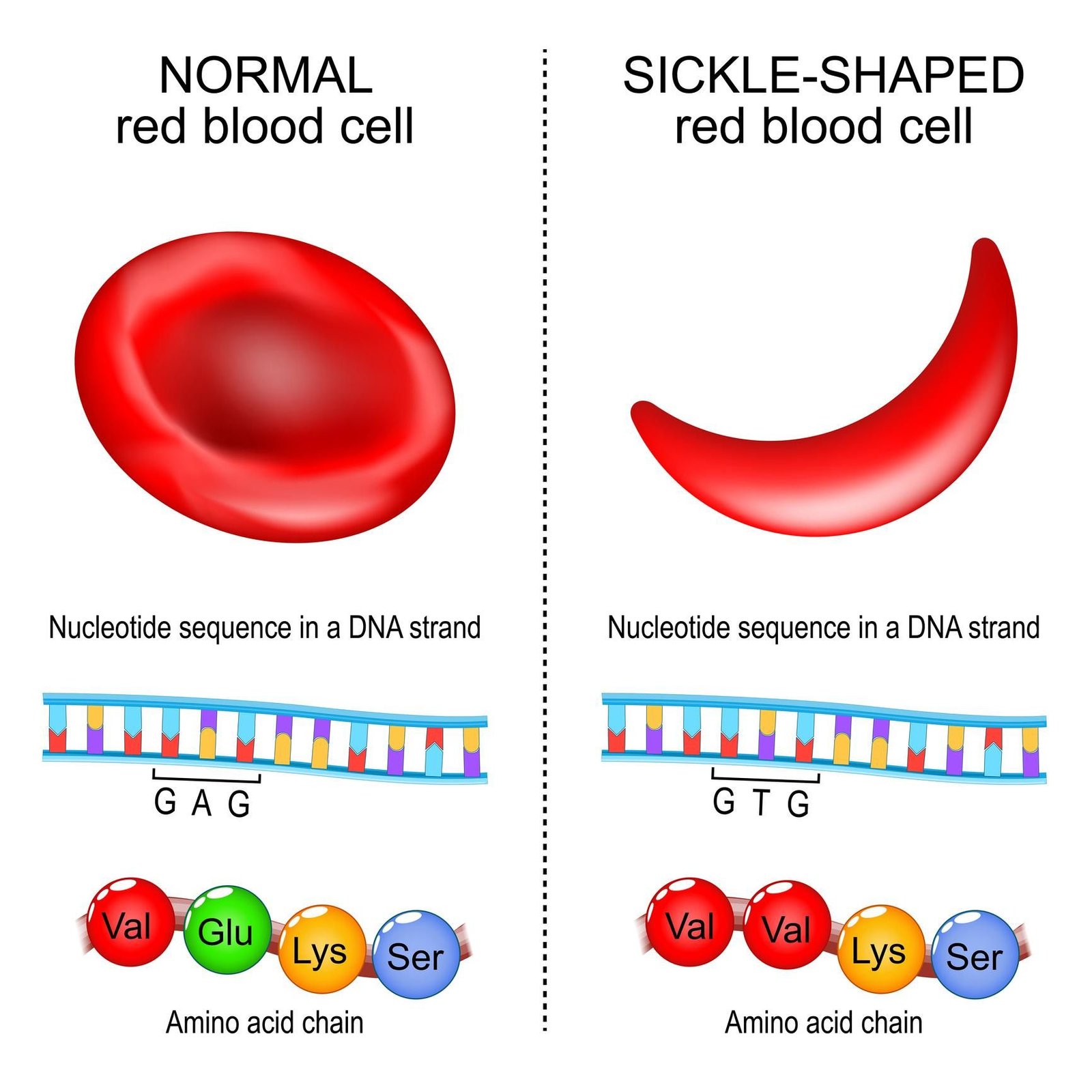 Microscopic comparison of normal round red blood cells and crescent-shaped sickle cells